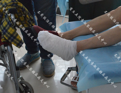 糖尿病人脚趾缝流脓流水溃疡一直无法痊愈的情况要怎么治疗?
