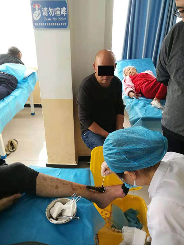 中西医结合不截肢治疗糖尿病足,清创有哪些要求和注意事项?