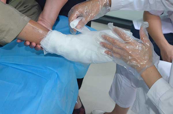 袁敏琴:糖尿病干性坏疽截肢是最好的方法吗?