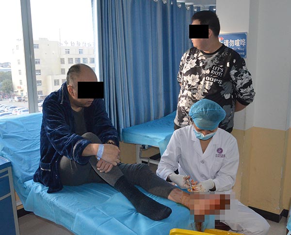 袁敏琴:用什么药水洗脚泡脚能缓解糖尿病烂脚吗?